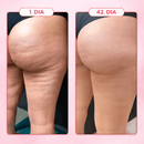Massageador Anticelulite Pro + 2 Óleos  de brinde